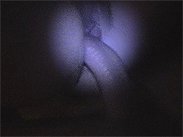 Night vision